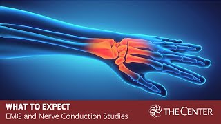 What to Expect During Nerve Conduction Studies and EMG Tests [upl. by Handal]