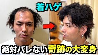 【髪の毛】若ハゲが絶対にバレないウィッグで人生を変える大変身 [upl. by Enirac]