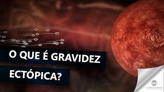 O que é gravidez ectópica [upl. by Keith]