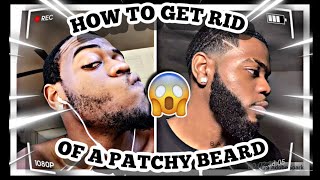 HOW TO FIX A PATCHY BEARD  PATCHY BEARD SOLUTION [upl. by Gross]