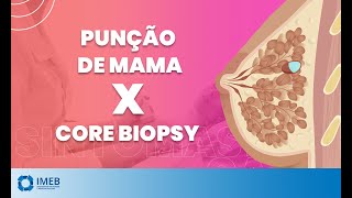 Qual a diferença entre Punção de Mama e Core Biopsy  IMEB [upl. by Oivaf85]