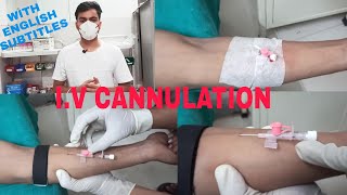 Intravenous Cannulation Technique  Iv Cannulation Procedure [upl. by Gambell251]