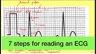 Read ecg step by step  Cardiovascular Physiology [upl. by Yro]