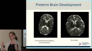 Neurodevelopment of Preterm Babies [upl. by Berne766]