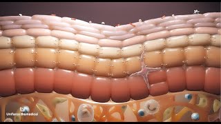 The Skin Barrier function [upl. by Gerard561]