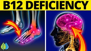 11 Weird Signs You Might Be Lacking Vitamin B12 [upl. by Assenar439]