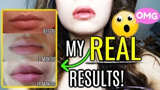 How To Get Plump Lips PERMANENTLY  BEFORE AND AFTER [upl. by Enenaj]