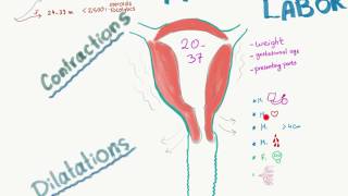 Preterm Labor visual summary [upl. by Notlim]