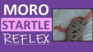 Moro Reflex Newborn Test  Startle Reflex  Pediatric Nursing Assessment [upl. by Ardnalak]