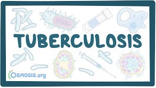 Extrapulmonary TB Part 2  Infectious diseases  NCLEXRN  Khan Academy [upl. by Immanuel]