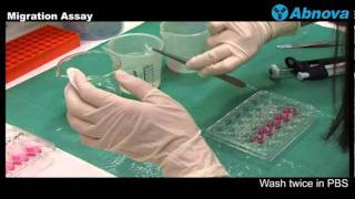 Migration Assay [upl. by Platus]