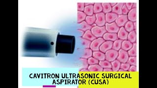 CAVITRON ULTRASONIC SURGICAL ASPIRATOR  CUSA [upl. by Anitsahs834]