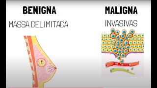 Neoplasia benigna x Neoplasia maligna [upl. by Gilli]