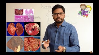 Necrosis amp Types of Necrosis Simplified [upl. by Halludba889]