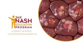 NASH liver disease progression in 3D from healthy liver to cirrhosis [upl. by Kinimod746]