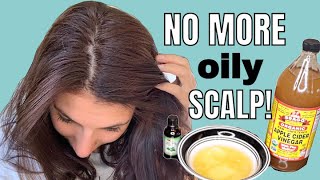 LIFE CHANGING DIY Hair mask for OILY HAIR  NO MORE OILY SCALP [upl. by Sordnaxela]