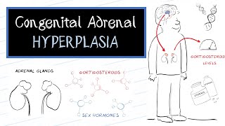 What is Congenital Adrenal Hyperplasia CAH [upl. by Ahsiekit]