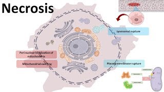 Necrosis  cellular mechanism and types [upl. by Eleynad]