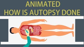 Autopsy Detailed animation on how is Autopsy done [upl. by Donaugh]