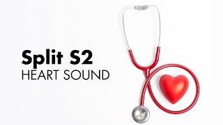 Fixed Split S2  Heart Sounds  MEDZCOOL [upl. by Allimac]