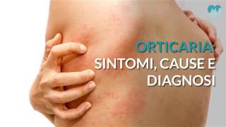 Orticaria sintomi cause e diagnosi [upl. by Trude]