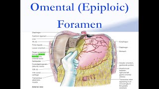 Omental Epiploic Foramen [upl. by Twedy214]