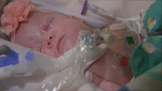 How do preemies develop differently [upl. by Sirref]