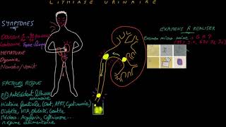 Lithiase urinaire  Docteur Synapse [upl. by Hands964]