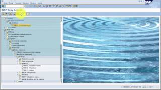 Intro to EKG Interpretation  Myocardial Infarctions Part 1 of 2 [upl. by Kcirdneked]