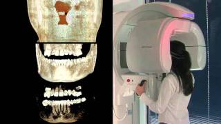 Cone Beam CT and 3D imaging [upl. by Jaye]