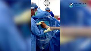 Frozen Shoulder Release Frisella Shoulder Surgery [upl. by Akemhs763]