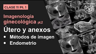 111  Imagen Ginecológica Métodos de estudio y patología endometrial [upl. by Balfore]