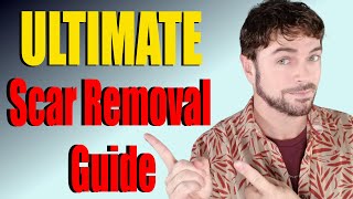 Scar Removal Products That Work  ULTIMATE Product Guide  Chris Gibson [upl. by Porter173]