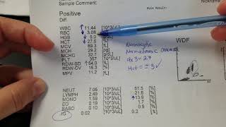 Hematology How to interpret automated Complete Blood Count CBC results [upl. by Bascio]