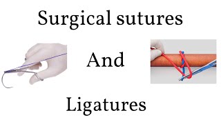 Rotator Cuff Repair with Arthrex® SutureBridge™ [upl. by Aihsemat]