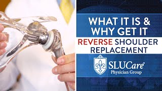 What Is A Reverse Shoulder Replacement  SLUCare Orthopedic Surgery [upl. by Hobard]