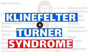 Klinefelter amp Turner syndrome  Pathology Clinical features Diagnosis and Treatment [upl. by Margie]