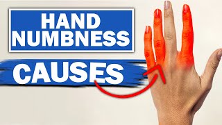 Expert Reveals MindBlowing Facts About Numbness amp Tingling In Fingers [upl. by Arretnahs]