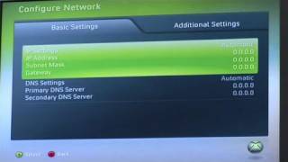 How To Connect Your Xbox 360 Live [upl. by Amadeo]