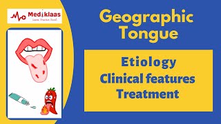 Geographic tongue Benign Migratory Glossitis [upl. by Nabetse677]