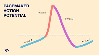 The ECG Course  Paced Rhythms [upl. by Ecnaralc]