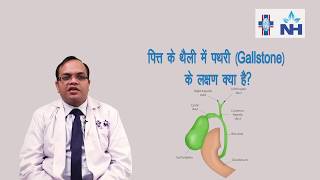 Understanding Gallbladder Stones Symptoms and Treatment  Dr Neeraj Goel [upl. by Chaim]