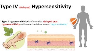 Type IV delayed hypersensitivity [upl. by Leonteen]