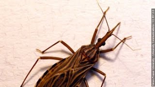 Kissing Bug Infections Are Growing In Texas Health Officials Say  Newsy [upl. by Llehsram298]