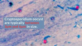 Cryptosporidium Filtration [upl. by Esiom]