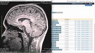 Training DrChrono Charts and Clinical Notes  Patient Documents [upl. by Nileuqcaj]