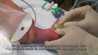 Paediatric Anaesthetics Chapter 7  Long saphenous IV neonate 1 [upl. by Durnan11]