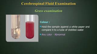 Cerebrospinal Fluid Examination CSF [upl. by Cavanagh]