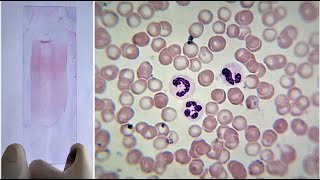 Blood Smear Preparation and Staining Practical Lab [upl. by Anstus]