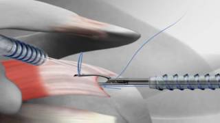 Dr Scalpels Guide to Surgery Sutures Episode 10 [upl. by Renelle197]